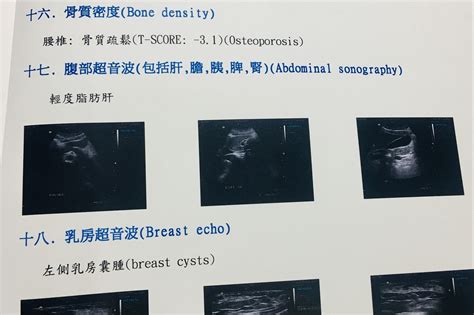 健康亮紅燈|健檢報告7項紅字，健康亮紅燈！調整作息補鈣多睡多。